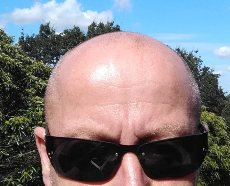 bald.webp