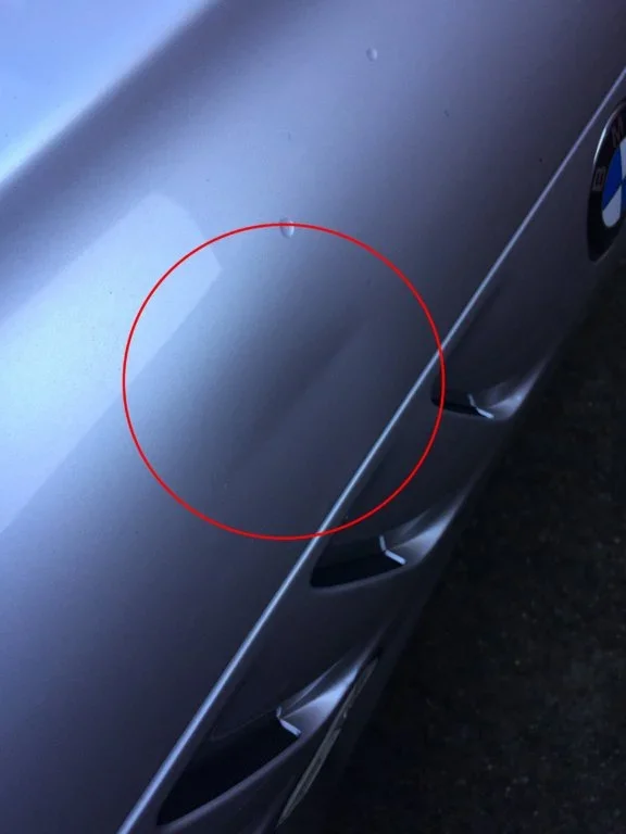 Dent - 3.webp